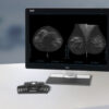 3DQuorum Imaging Technology, powered by Genius AI Animation